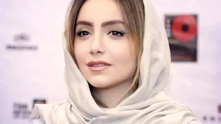 چهره متفاوت نازنین بیاتی قبل از عمل های زیبایی