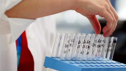 کنترل ضد دوپینگ در لیگ / ۲ بازیکن پرسپولیس و چادرملو تست دادند