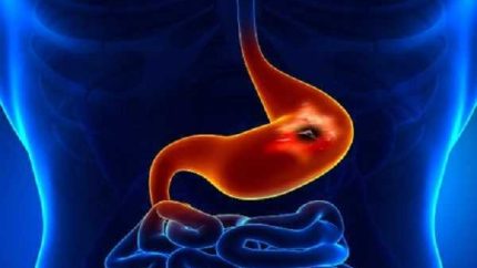 این خوراکی‌ها بلای جان معده‌اند / اگر سوءهاضمه دارید، مصرف این غذاها می‌تواند علائم را تشدید کند / از نفخ و دل‌درد تا احساس سنگینی؛ بخوانید