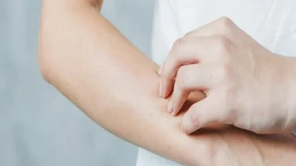 علت خارش بدن در شب چیست؟ بررسی کامل دلایل، از تغییرات طبیعی تا بیماری‌های جدی + راهکارهای درمانی