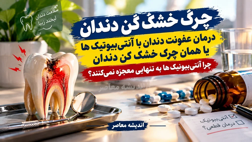چرک خشک کن دندان | درمان عفونت دندان با آنتی‌ بیوتیک‌ ها یا همان چرک خشک کن دندان / چرا آنتی‌ بیوتیک‌ ها به تنهایی معجزه نمی‌کنند؟